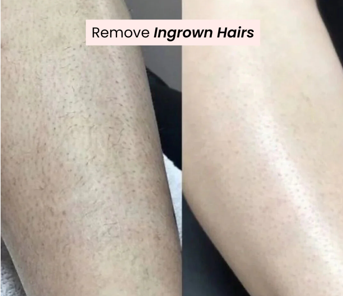 Bald Cat Trim™ - Precision 2 Way Bikini Trimmer