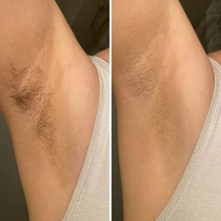 Bald Cat Trim™ - Precision 2 Way Bikini Trimmer