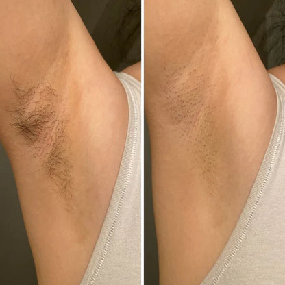 Bald Cat Trim™ - Precision 2 Way Bikini Trimmer