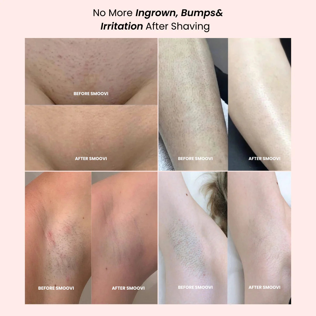 Bald Cat Trim™ - Precision 2 Way Bikini Trimmer