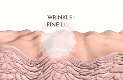 Elevé Tapes™ - Facial Lift Japanese Tapes - Botox Alternative | Anti-Wrinkle